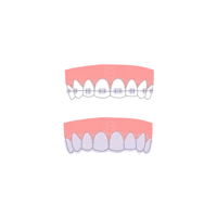 Ilustración de Ortodoncia