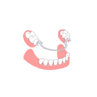 Ilustración de Prótesis Dentales