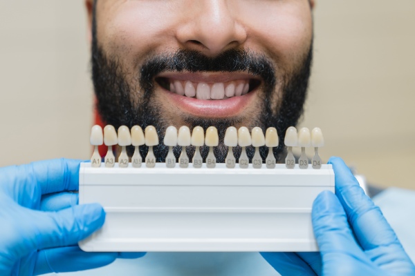 Blanqueamientos Dentales