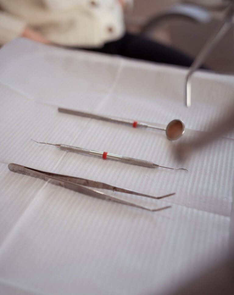 ¿Cuándo conviene cambiar un empaste (resina) viejo? Señales de filtración, dolor al morder y control odontológico en Recoleta